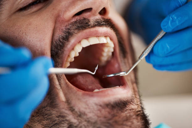 Best Broken or Cracked Tooth Emergency Dentist in Heyworth, IL